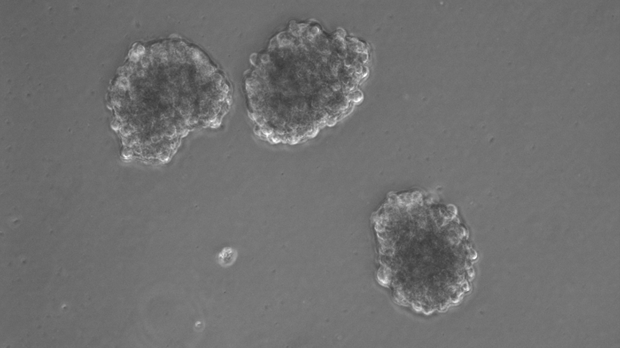 closeup black and white microscope view of cell clumps