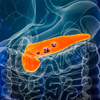 Pancreas or pancreatic cancer with organs and tumors or cancerous cells 3D rendering illustration with male body.