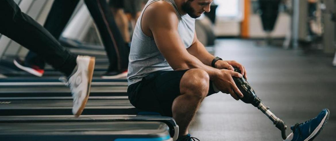 man with prosthetic leg sitting on treadmill