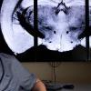 Dr. Sam Grant uses the imaging power of a 21 Tesla magnet to see inside the brain during migraine.