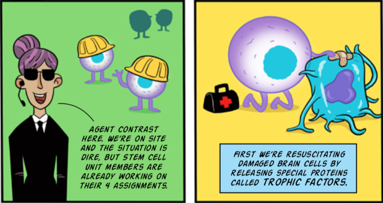stroke illus 5