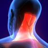 neck muscle illustration