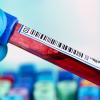 closeup of hand holding vial of red blood
