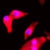 photo of red and purple stained cells on black background from inside a microscope