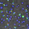 miroscope photo of macrophages colored purple and green on a black background